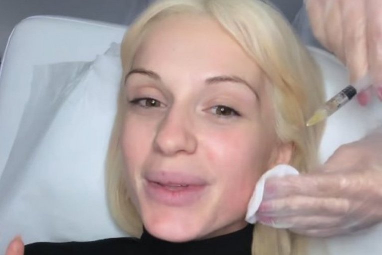 GLUMICA NAKON POROĐAJA OTIŠLA NA REMONT! Anja Mit više ne izgleda isto