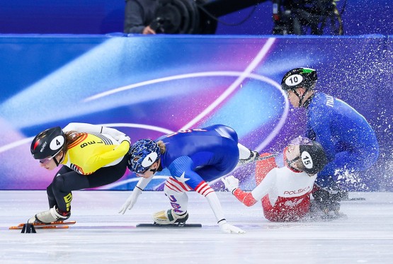 Klizaljka joj rasjekla lice na ZOI, pokazala kako sada izgleda (FOTO)