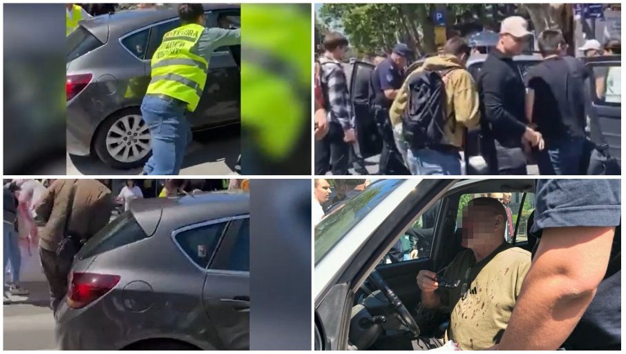 "SVAKOGA DANA TRPIMO SVE VEĆE LUDILO" Lažomer: Bolest blokadera ne zna za granice